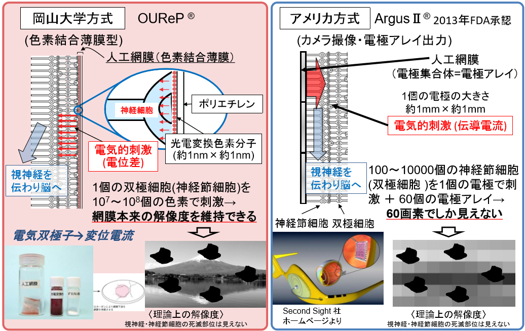 岡山大学が開発する人工網膜「OUReP®」とアメリカの人工網膜「ArgusⅡ®」（提供：岡山大学）