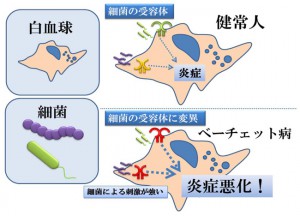 病 ベーチェット