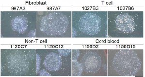 京大など、細胞移植に適した新しいヒトiPS細胞の樹立・維持培養法を確立