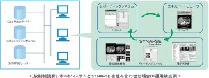富士フイルム、類似症例検索システム 「SYNAPSE Case Match（シナプス ケース マッチ）」が肝臓がんに対応
