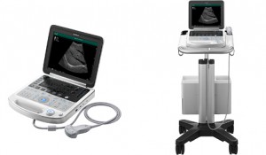 富士フイルム、高解像度を実現した次世代携帯型超音波画像診断装置を発売