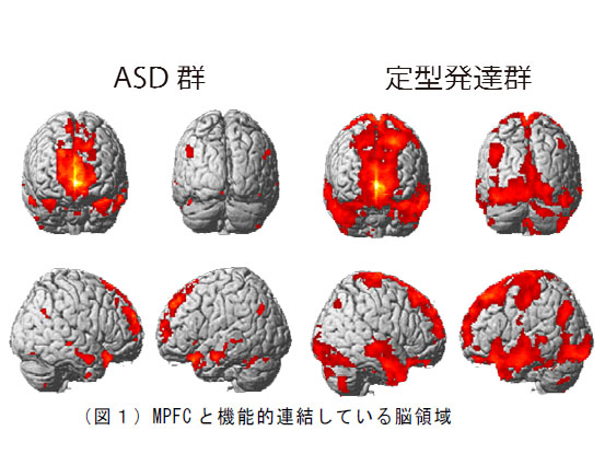 名大ら，安静状態の脳活動パターンが自閉症スペクトラム傾向に関与することを発見