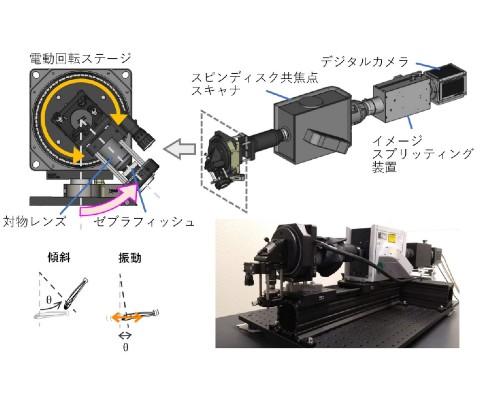 有毛細胞白血病とは何ですか?