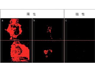 国がんら，HSIで便表面の便潜血の画像化