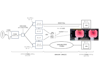 NTTら，APNでクラウド内視鏡システムの実現へ