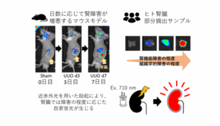阪大、近赤外光で腎障害を非侵襲イメージング